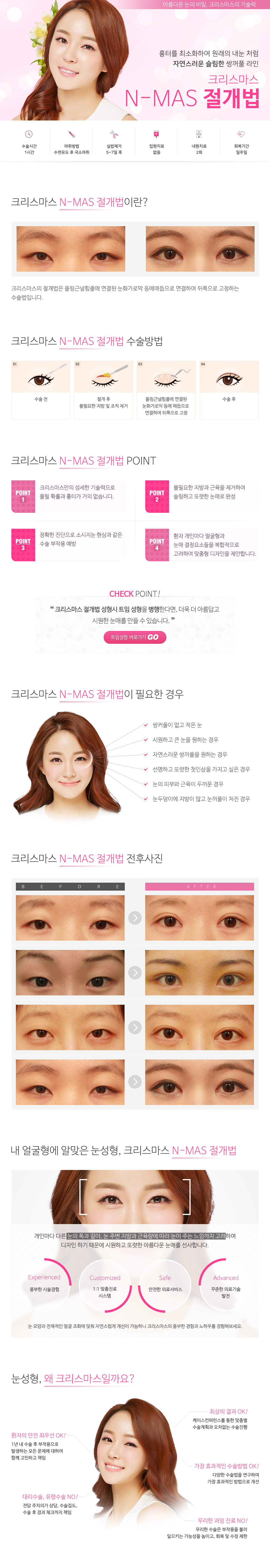 시크릿절개법/쌍커풀(절개)