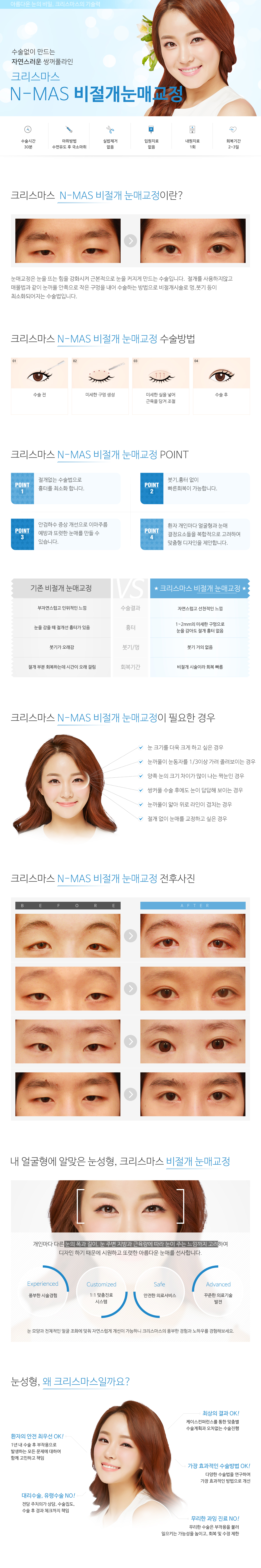 비절개눈매교정/눈매교정(비절개)