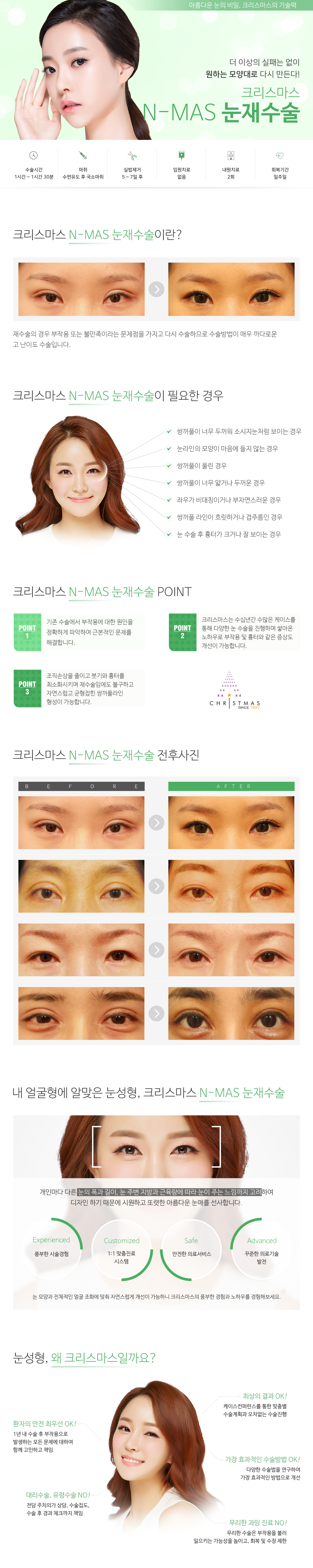 눈재수술