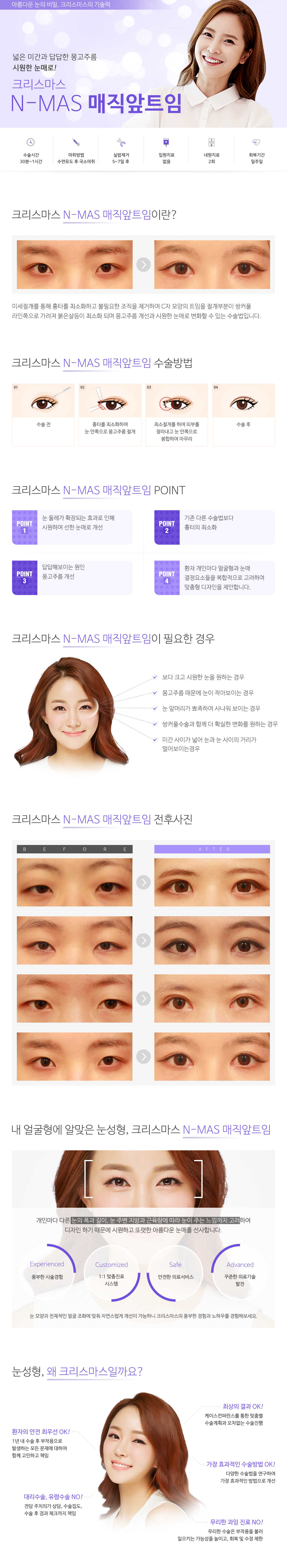 앞트임/매직앞트임