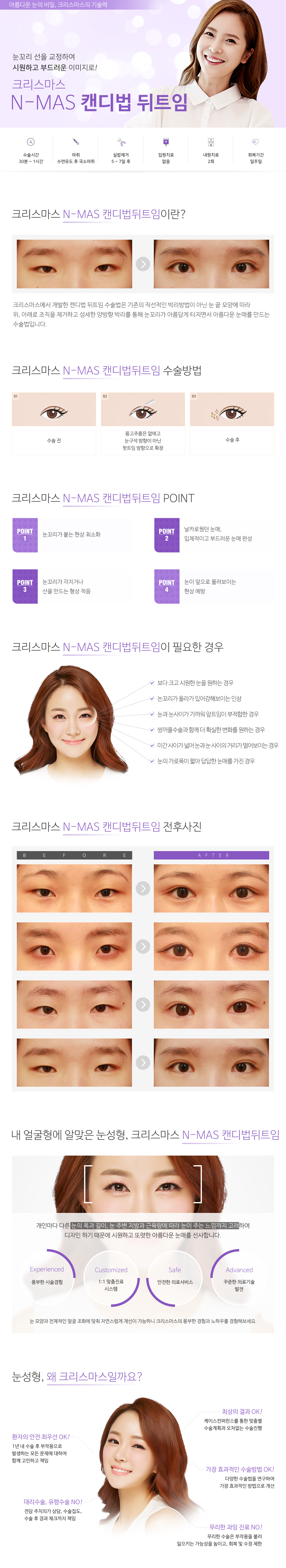 뒤트임/캔디법뒤트임