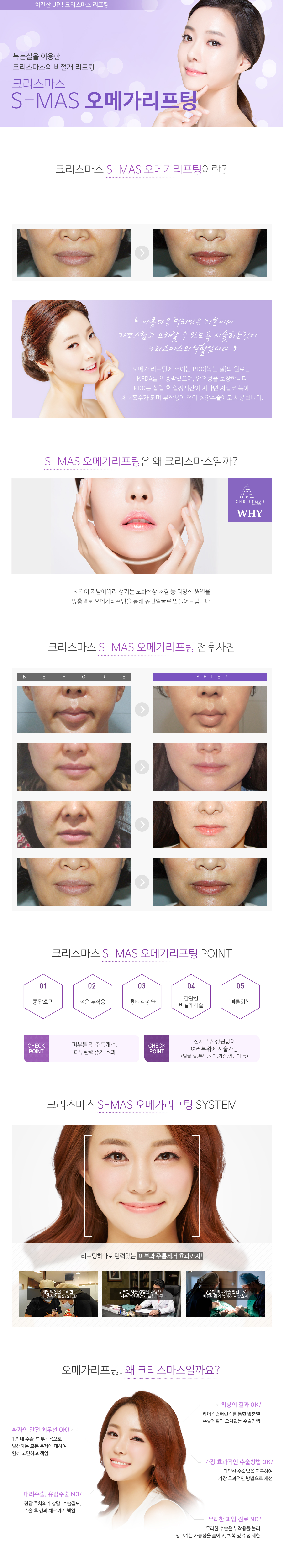 리프팅