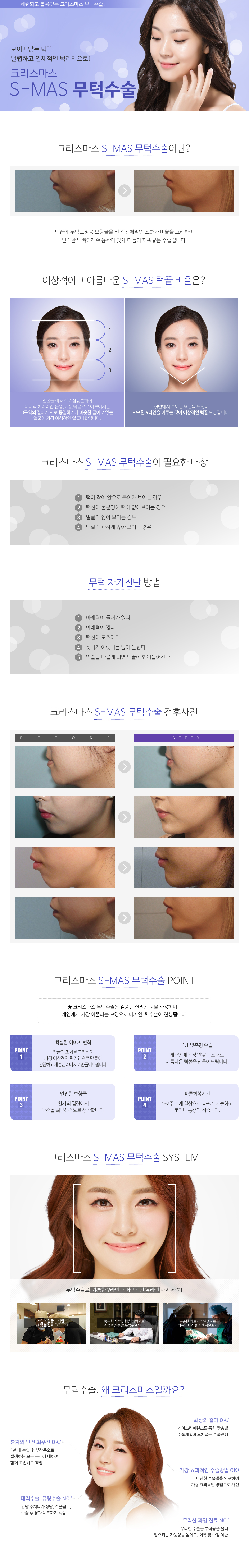 무턱수술