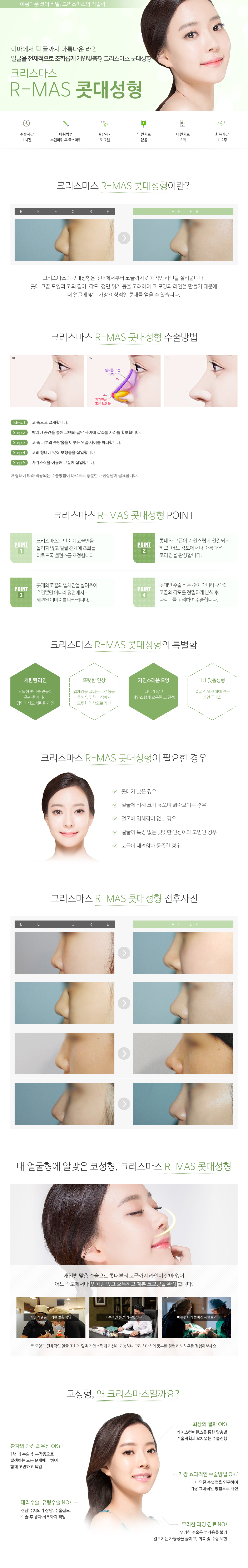 콧대/라이트콧대성형