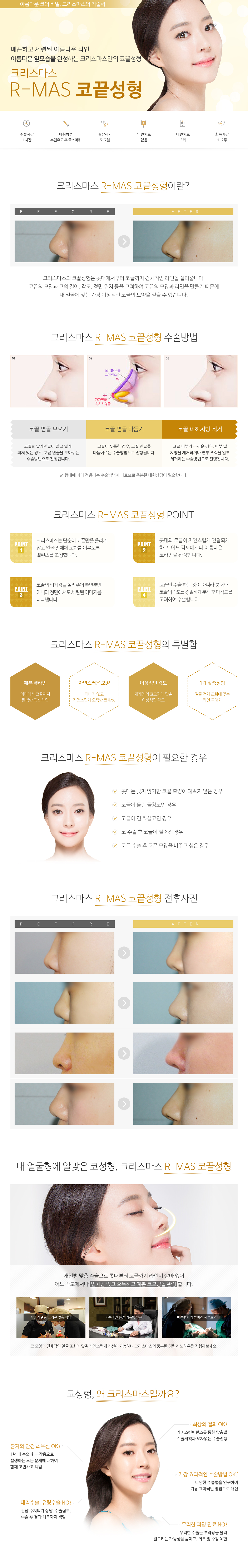 코끝/소프트코끝성형