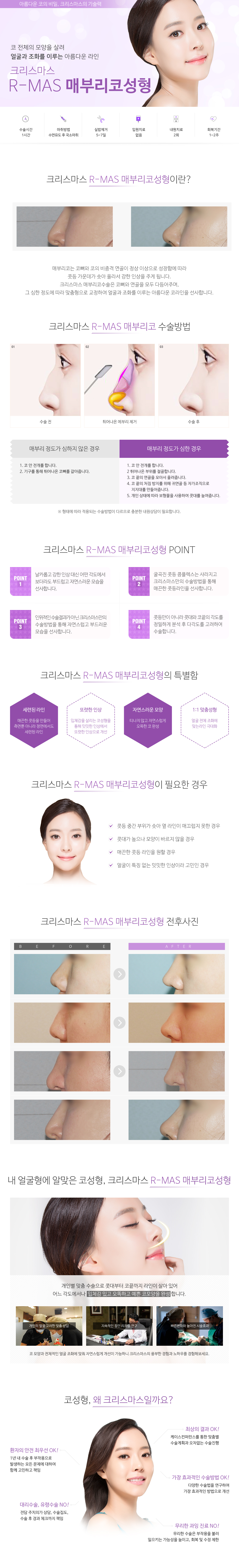 매부리코성형