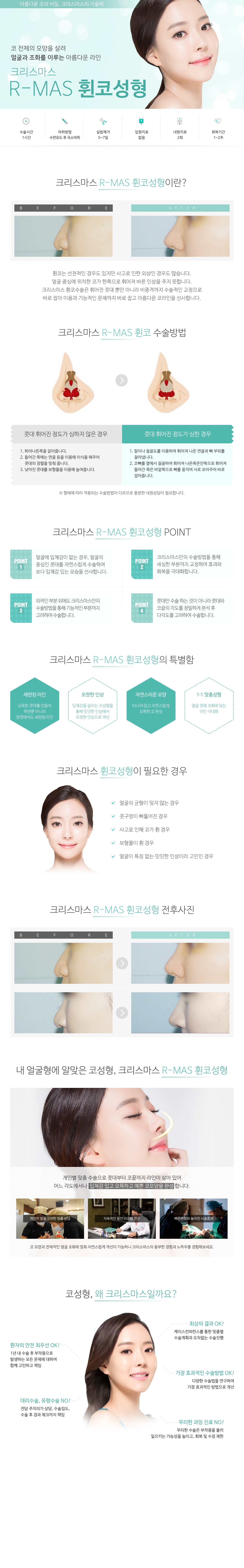 휜코성형