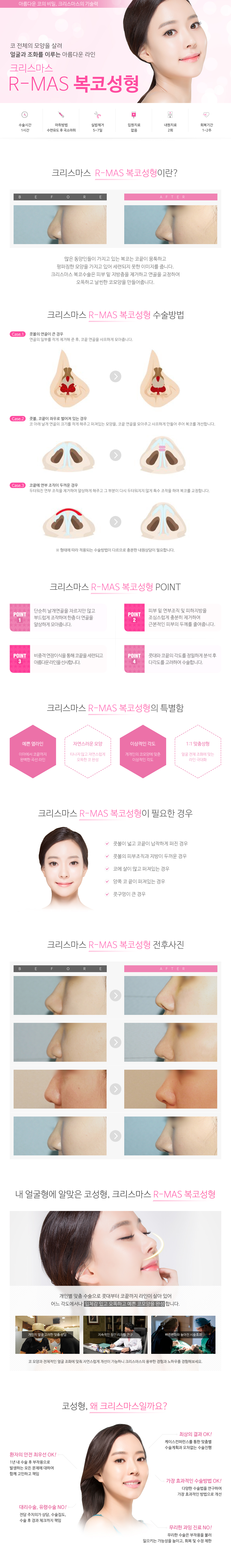 복코성형